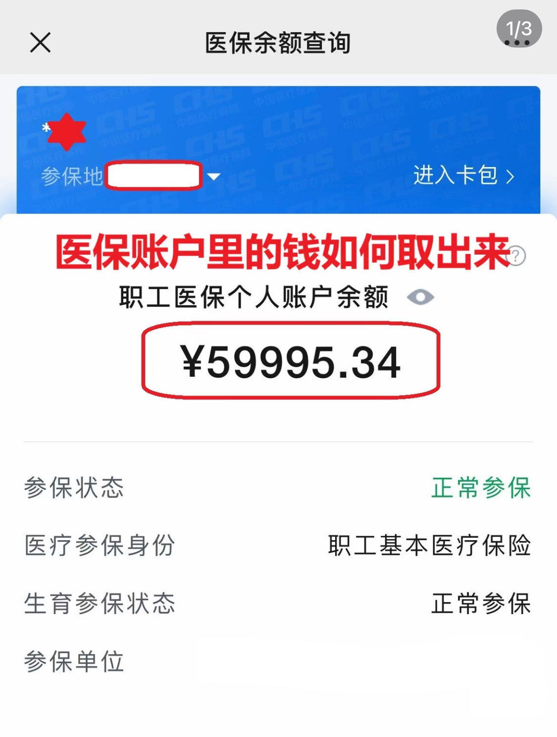 琼海为什么医保卡里没有钱(为什么医保卡里没有钱还可以报销)