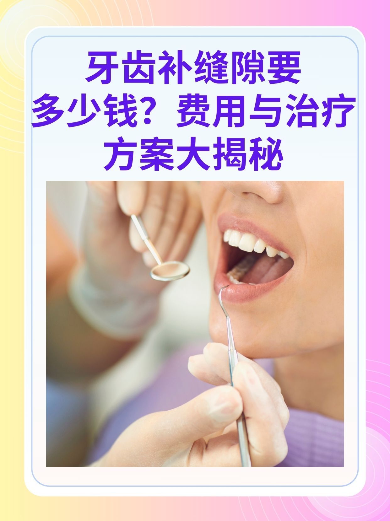 琼海补牙医保可以报销吗(补牙医保可以报销吗 哪些可以报销呢)